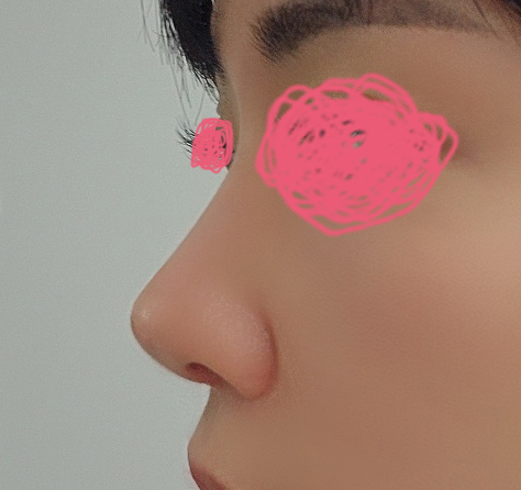 부작용없이 자연스럽게 잘 해주셨어요!