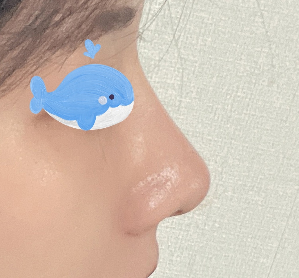 지인소개받고 바이브에서 코했습니다:)