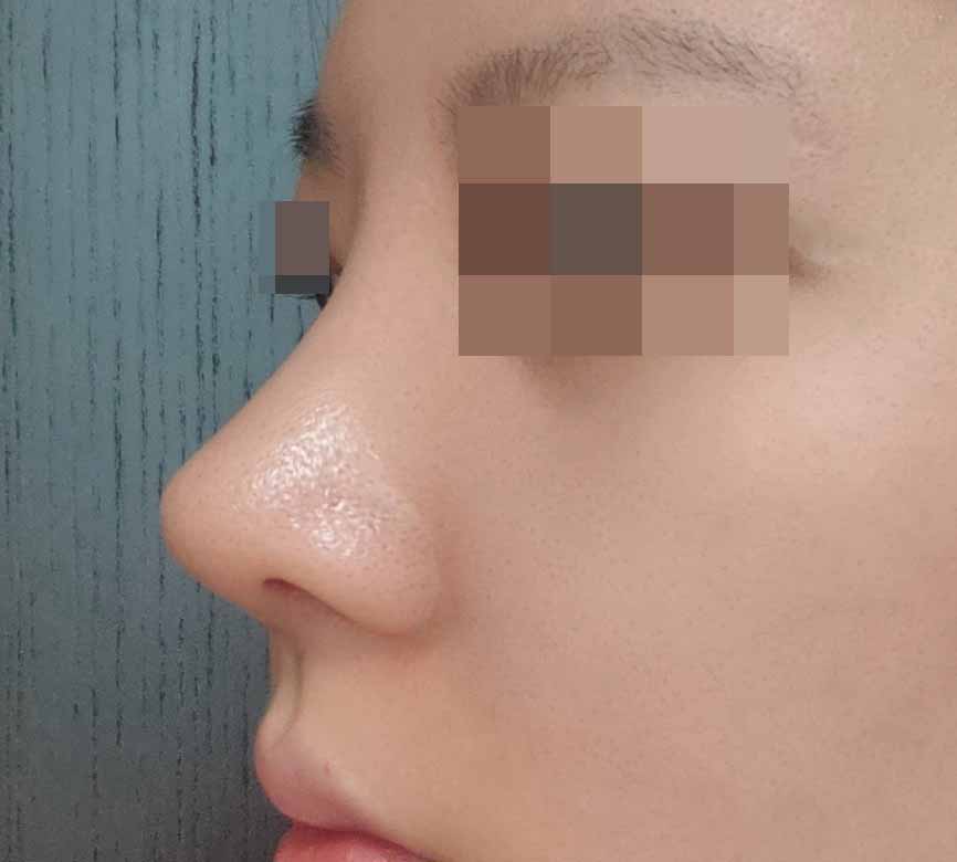 콧등이랑 코끝이 얄상해진거 보면 아주 뿌듯해요