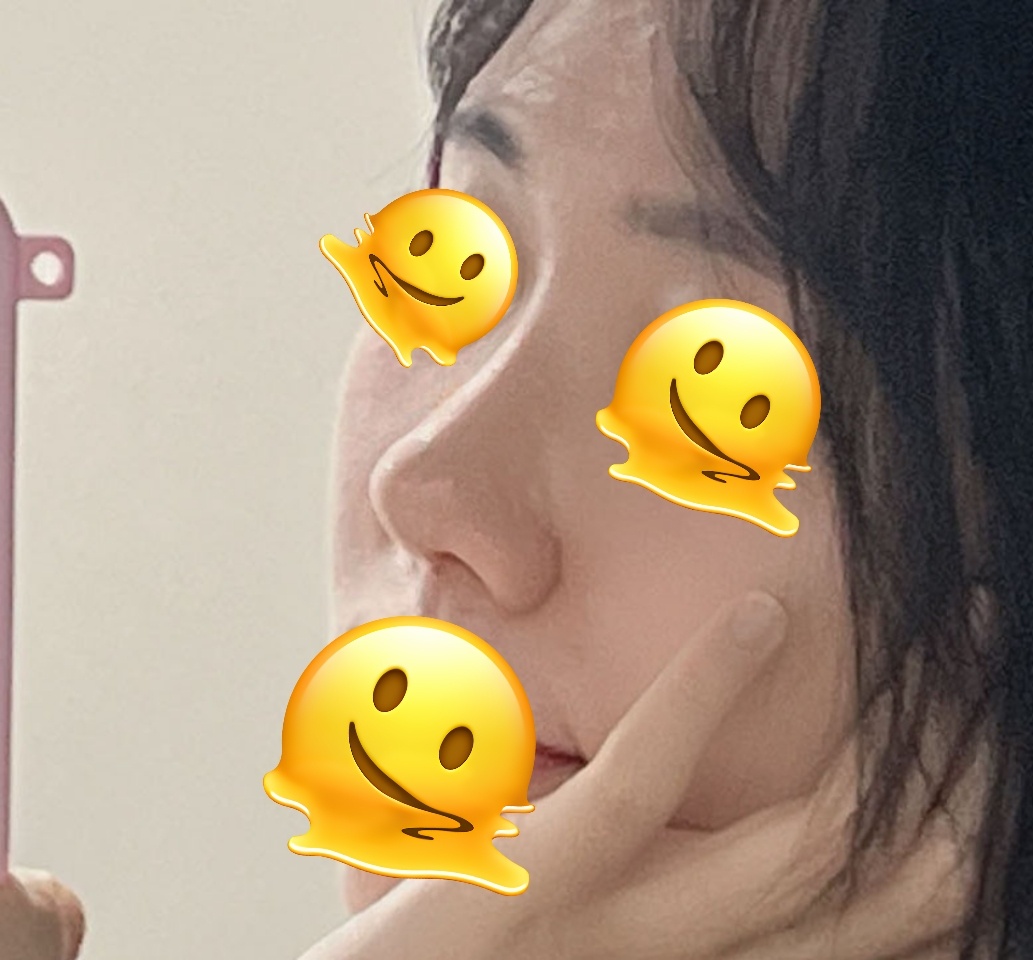 코성형은 바이브인듯요!!