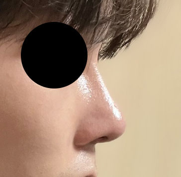 제 자존감도 올라갔어요~ 코 맘에 듭니다