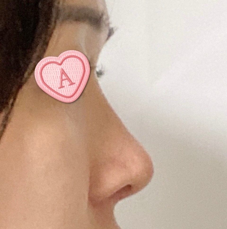 유원장님 코성형장인이에요~