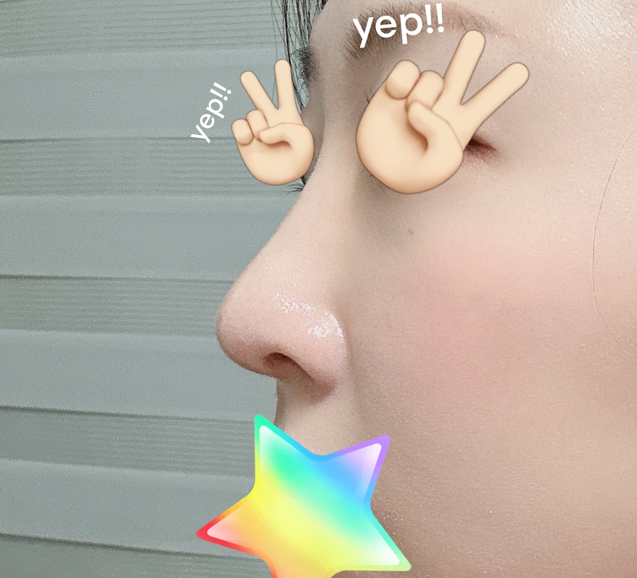 코수술한거 이번 년도에 가장 잘한 일같아요 ㅎㅎ