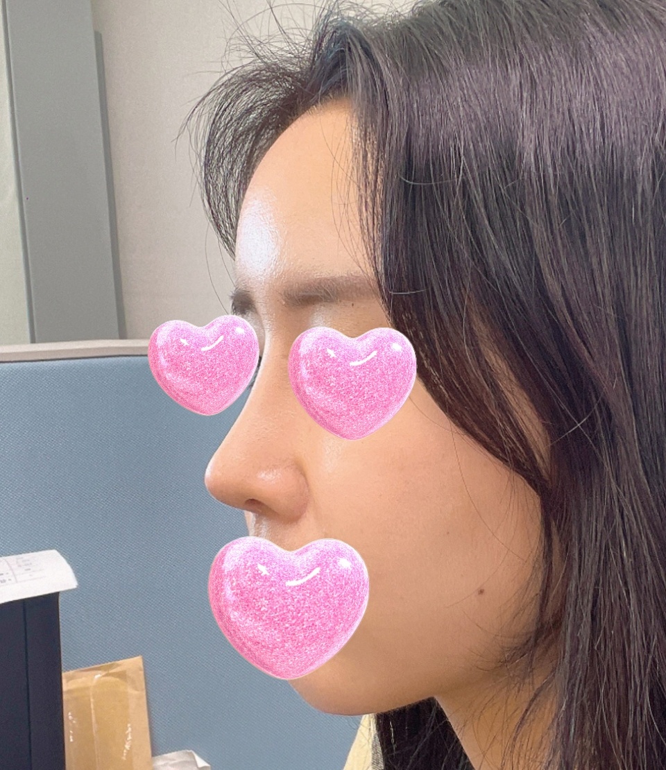 얼굴라인 존예ㅠ.ㅠ