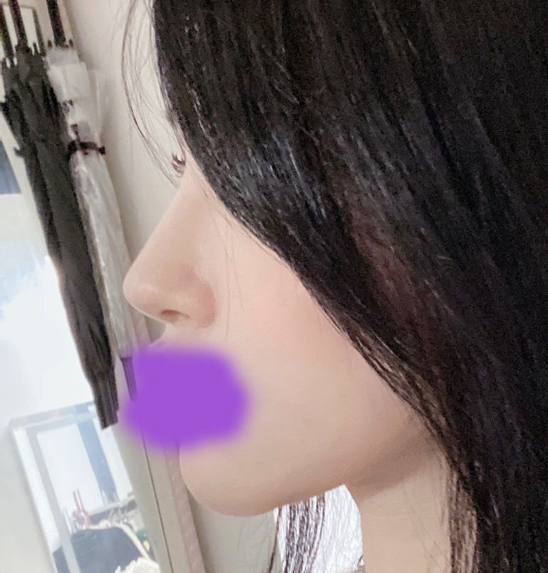 코라인, 얼굴라인 good!