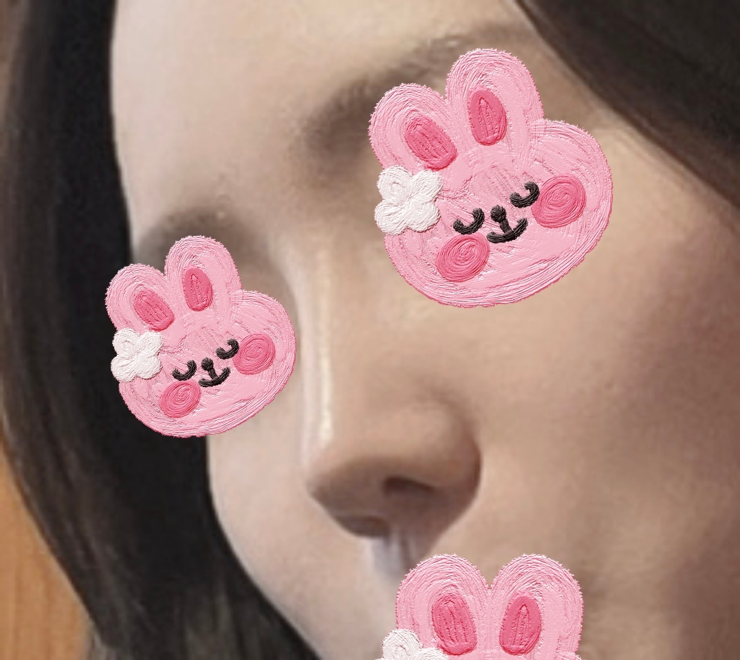 코수술 후 이미지개선 성공!!