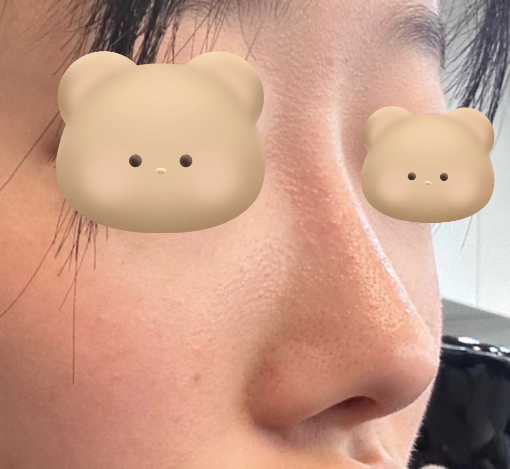 코6개월차! 자연스럽게 잘 유지중!