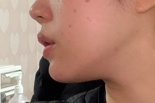 얼지흡 완전추천