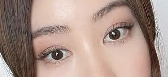 눈 코 3개월차에요