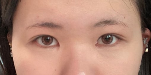 눈 4개월차 만족스러워용