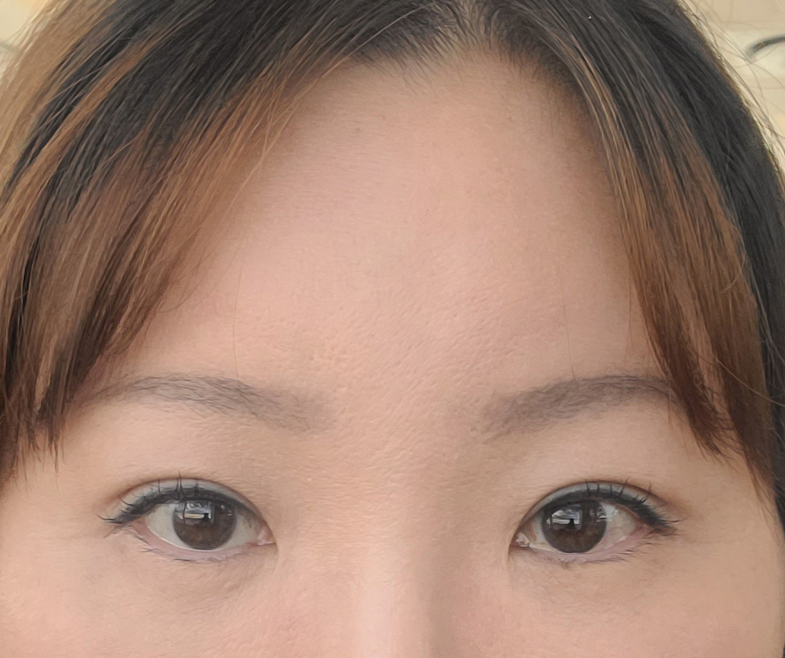 상안검, 이마거상술했습니다^^*