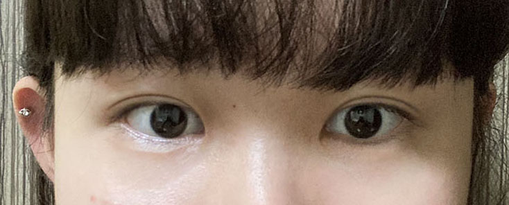 쌍수 완전 대~만족이요!