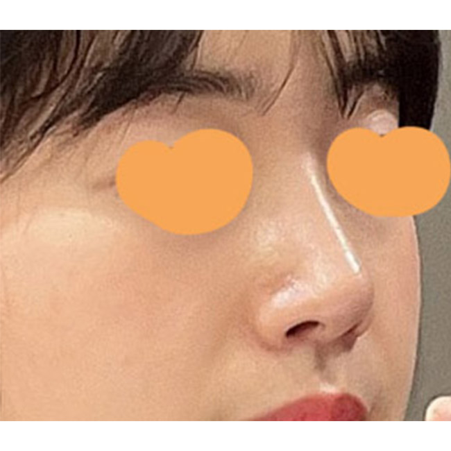 바이브에서 눈, 코했어요~