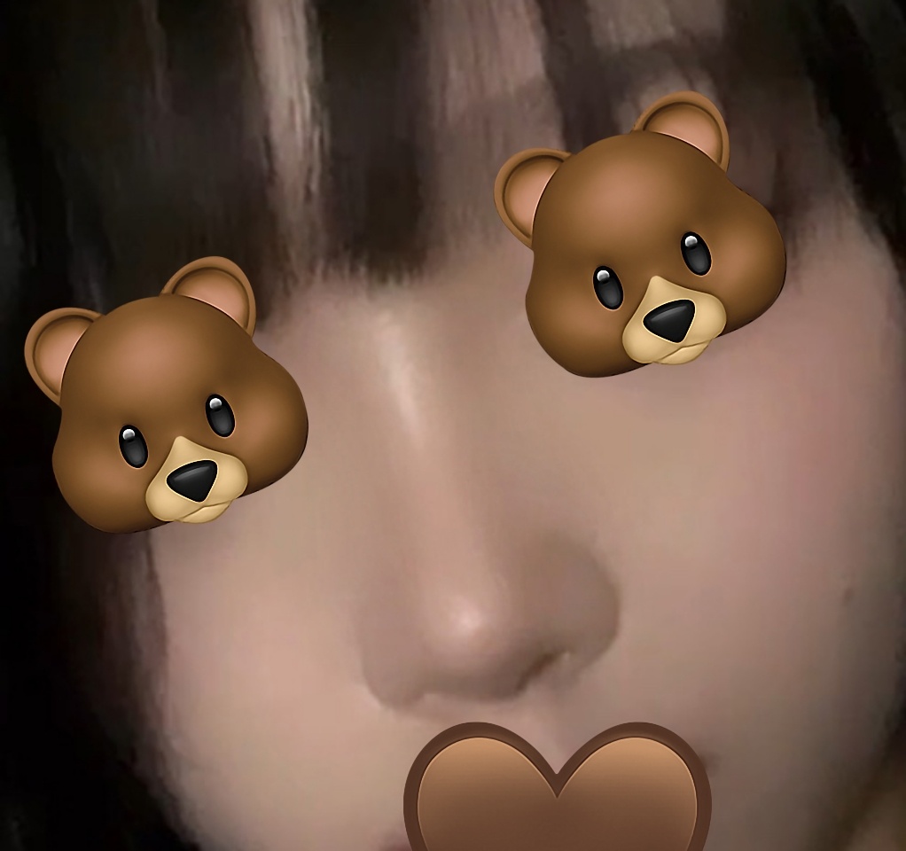 동글동글했던 복코, 수술했습니닷!