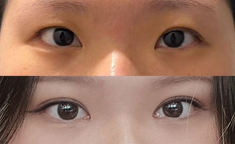 유영문원장님 신의손이신듯!