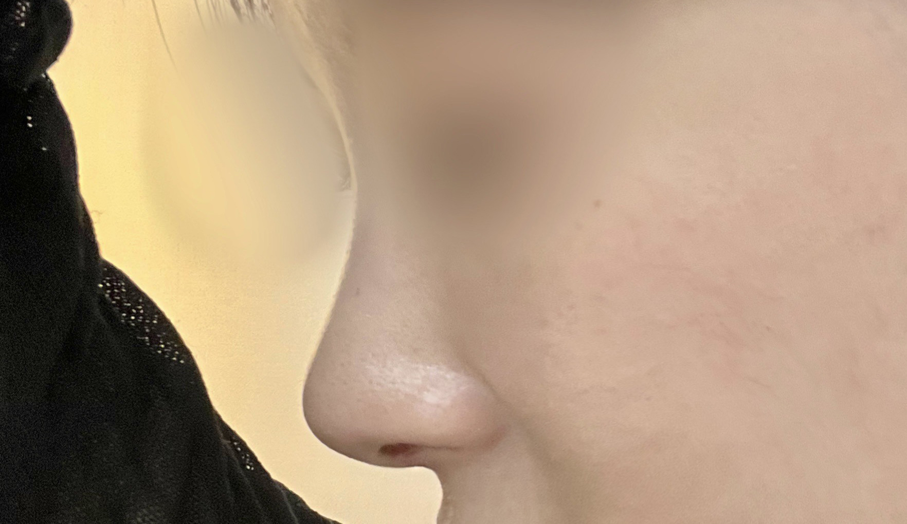 주변에서 코 어디서했냐고 많이 물어봐요 ㅎㅎ