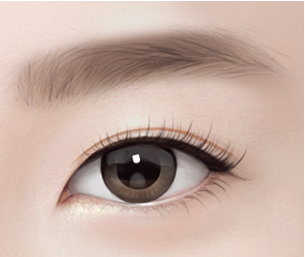 절개 눈매교정 Step 04